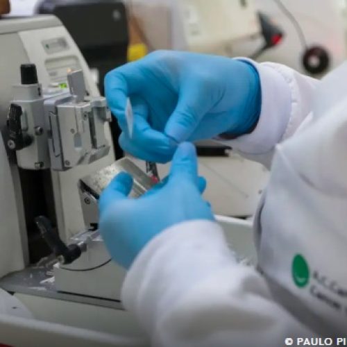 Cura de câncer de próstata pode chegar a até 98%