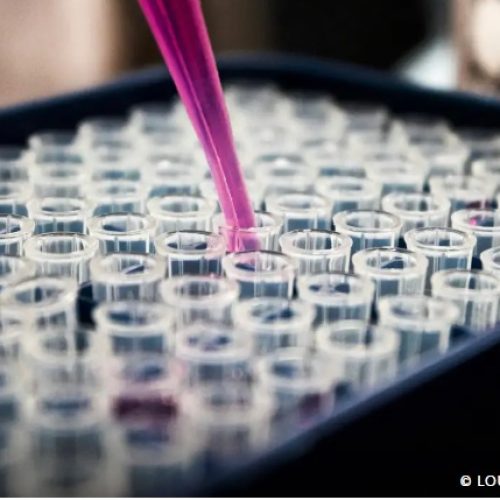 Estudo mostra que inflamação no cérebro pode ser chave do Alzheimer